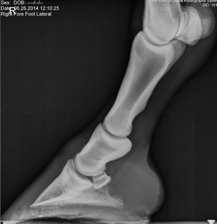 normal foot xray lateral