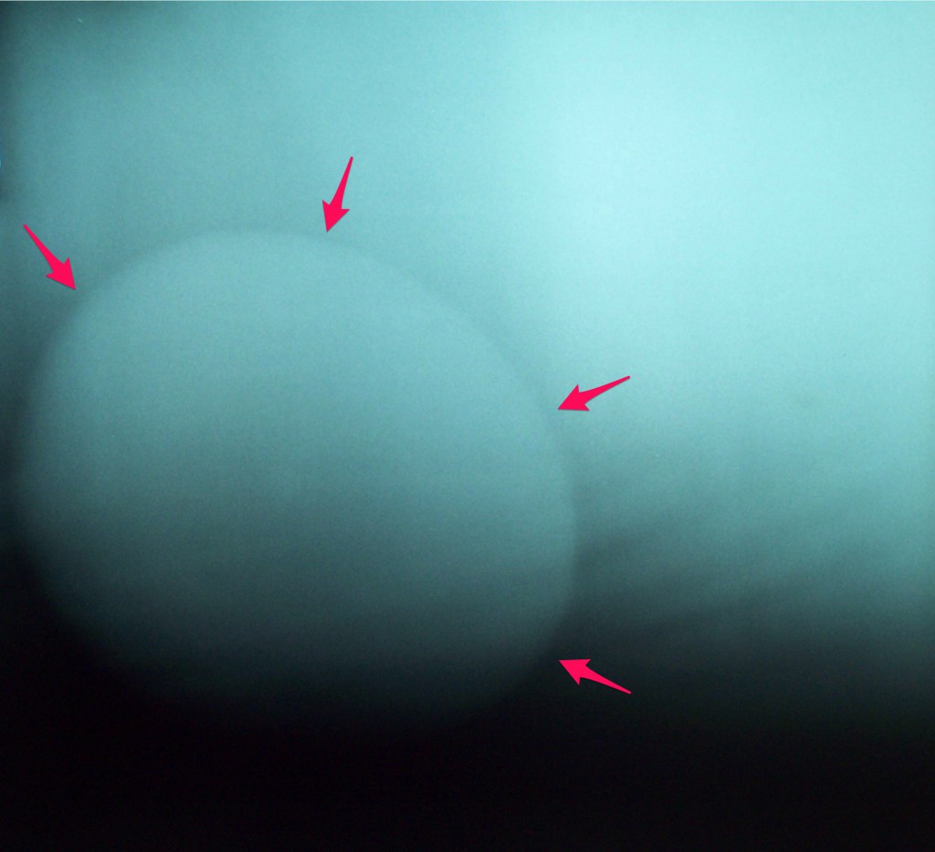 Enterolith x-ray