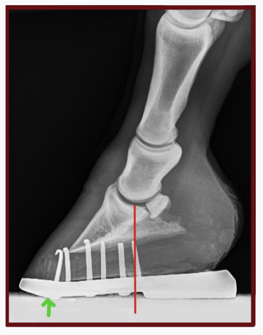 AP, Lateral and Axial views of the ankle joint showing calcaneal... |  Download Scientific Diagram