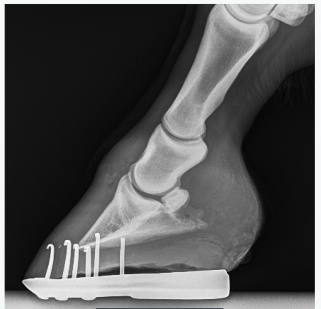 Initial shoeing was a navicular style shoe, but placed quite far forward on the foot. In this case, it was not the shoe, but the placement that mattered the most. This horse was not being helped by the shoe nearly as much as it should have been.