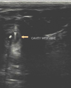 cross section ultrasound wire in draining tract foreign body throatlatch