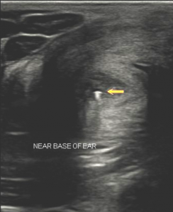 ultrasound wire forign body throatlatch