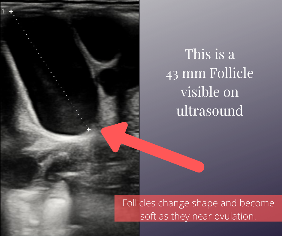 FollicleUltrasound